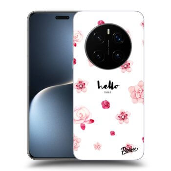 Θήκη για Honor Magic7 Pro 5G - Hello there