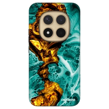 Picasee Fashion Case για Xiaomi Redmi Note 15 Pro+ - Goldsky