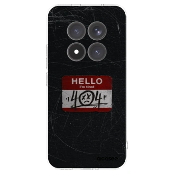 Picasee διαφανής θήκη σιλικόνης Xiaomi Redmi Note 15 Pro+ - HELLO 404