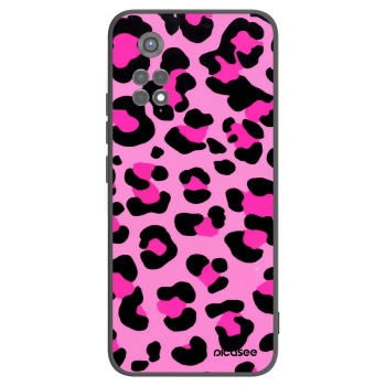 Picasee Μαύρη θήκη σιλικόνης για Xiaomi Redmi Note 11S 5G - Pink Tiger