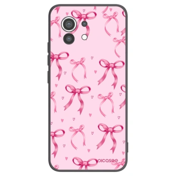 Picasee Μαύρη θήκη σιλικόνης για Xiaomi Mi 11 - Bow Aesthetic