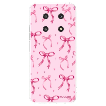 Picasee διαφανής θήκη σιλικόνης Honor Magic4 Lite 5G - Bow Aesthetic