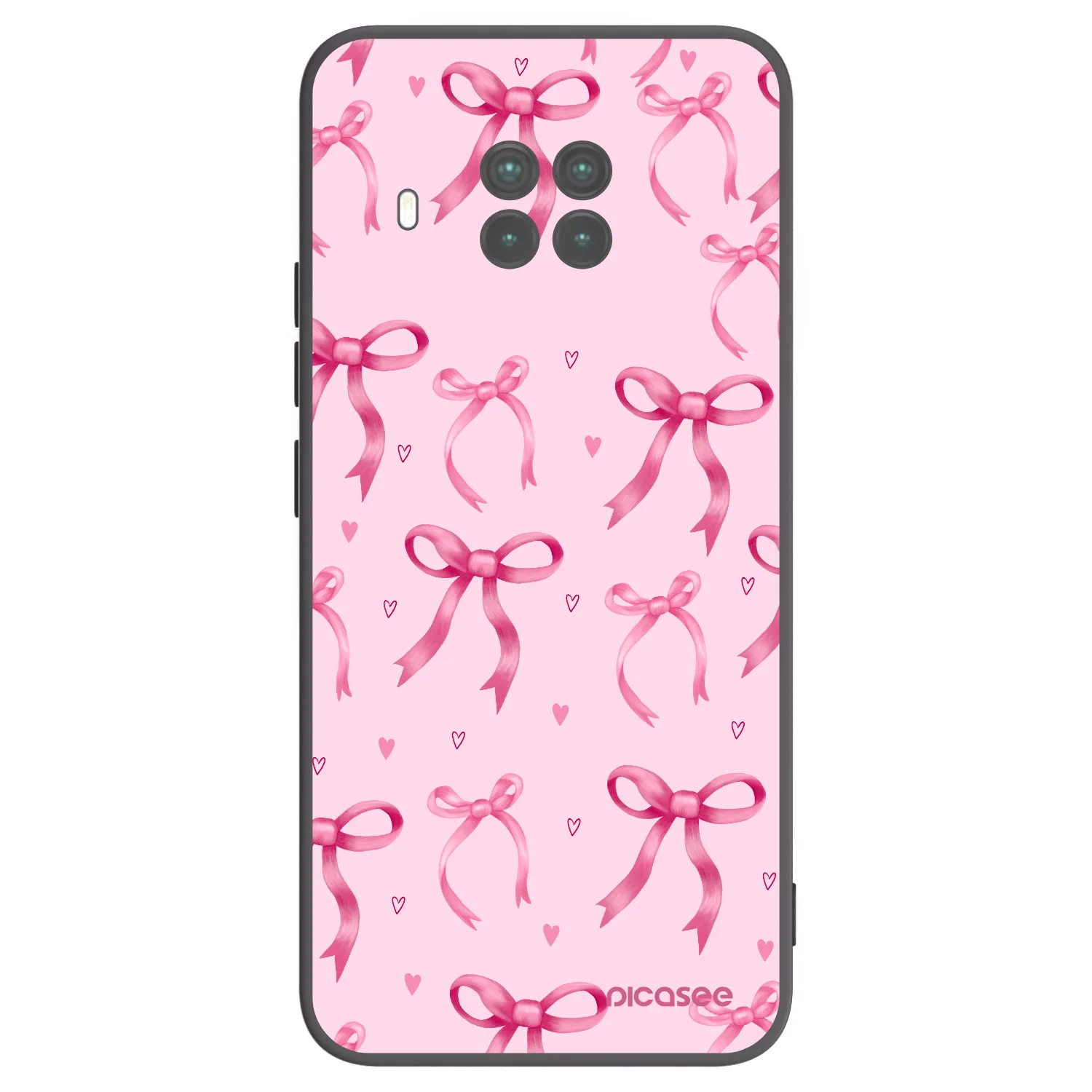 Picasee Μαύρη θήκη σιλικόνης για Xiaomi Mi 10T Lite - Bow Aesthetic