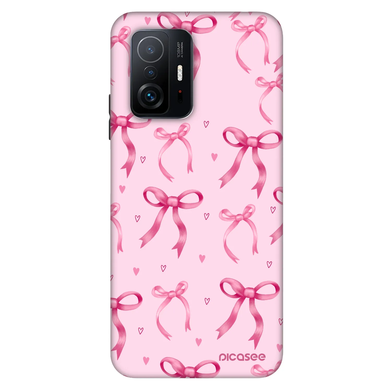 Picasee Fashion Case για Xiaomi 11T - Bow Aesthetic