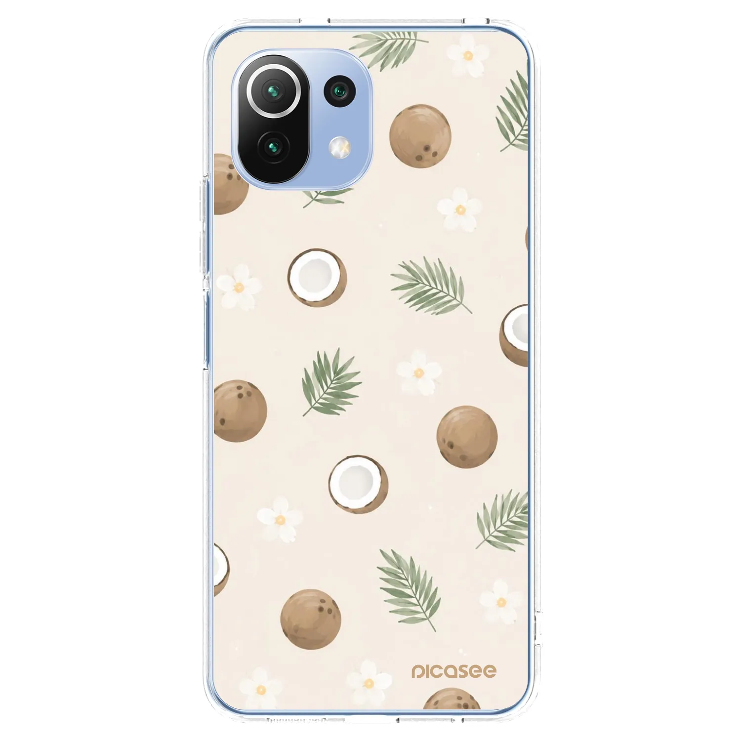 Picasee διαφανής θήκη σιλικόνης Xiaomi Mi 11 Lite - Coconut Breeze