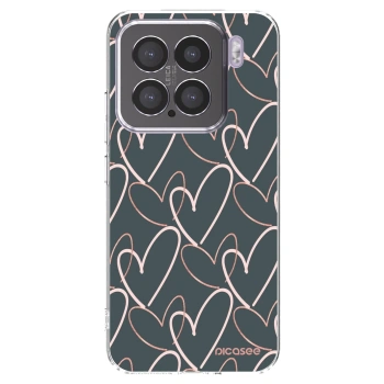 Picasee διαφανής θήκη σιλικόνης Xiaomi 15 - Lots of love