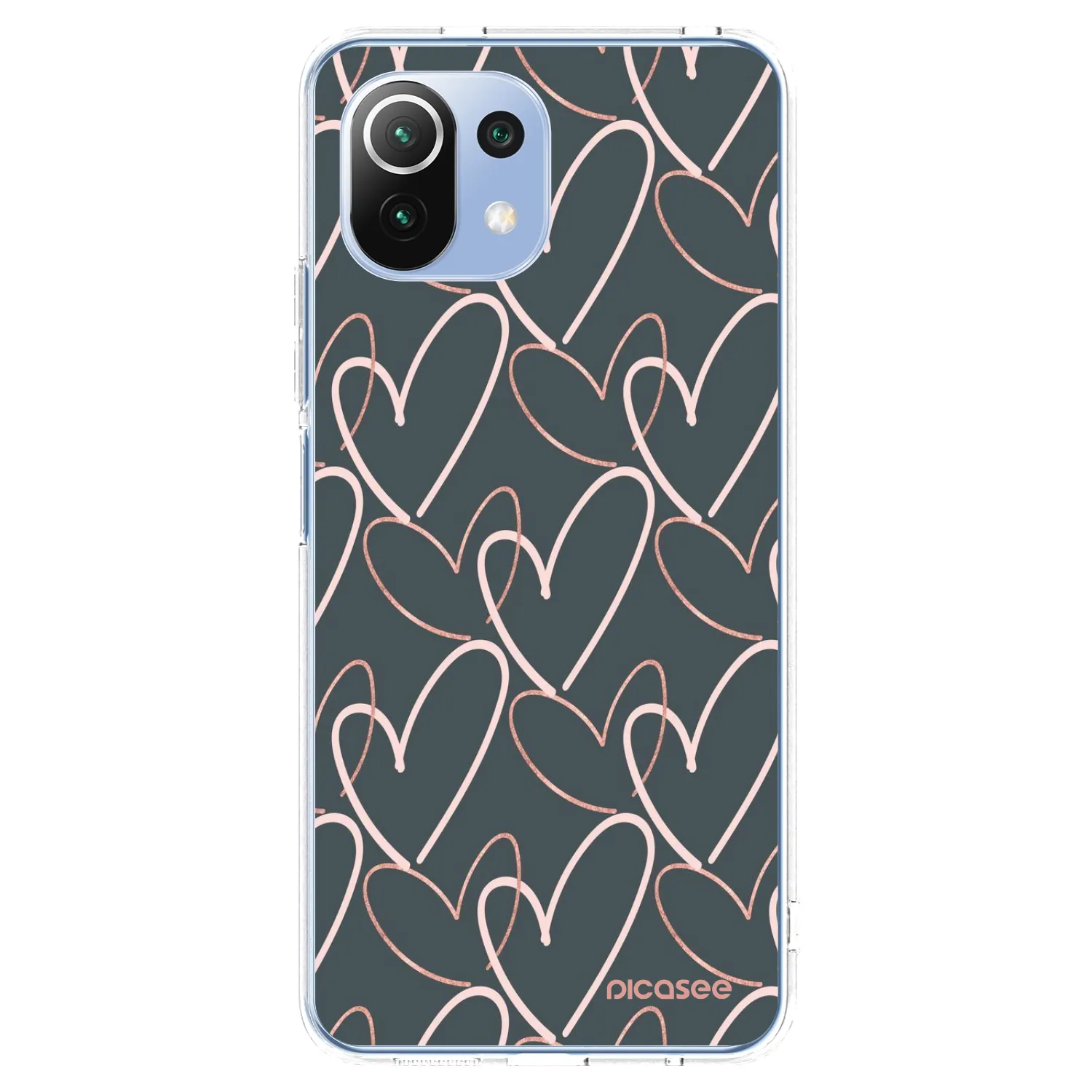 Picasee διαφανής θήκη σιλικόνης Xiaomi Mi 11 Lite - Lots of love