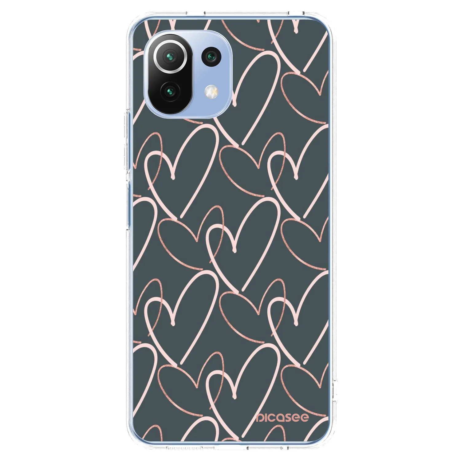 Picasee διαφανής θήκη σιλικόνης Xiaomi 11 Lite 5G NE - Lots of love