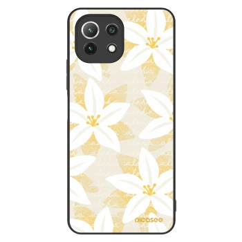 Θήκη για Xiaomi Mi 11 Lite - Island Leave